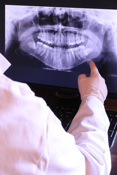 Best Dental Abscess Treatment in Flying Hills, PA