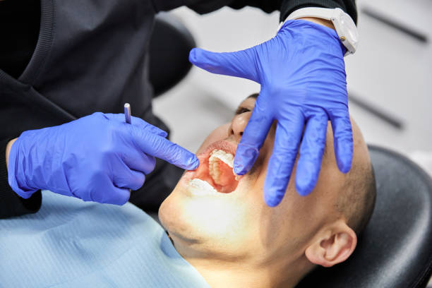 Best Emergency Dental Care for Sports Injuries in Flying Hills, PA